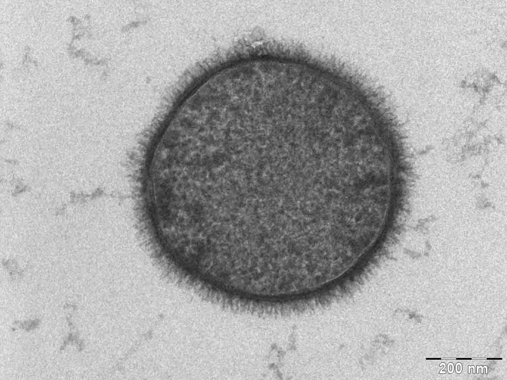Bild av höbakterien Bacillus Subtilis, tagen med transmissionsmikroskop.