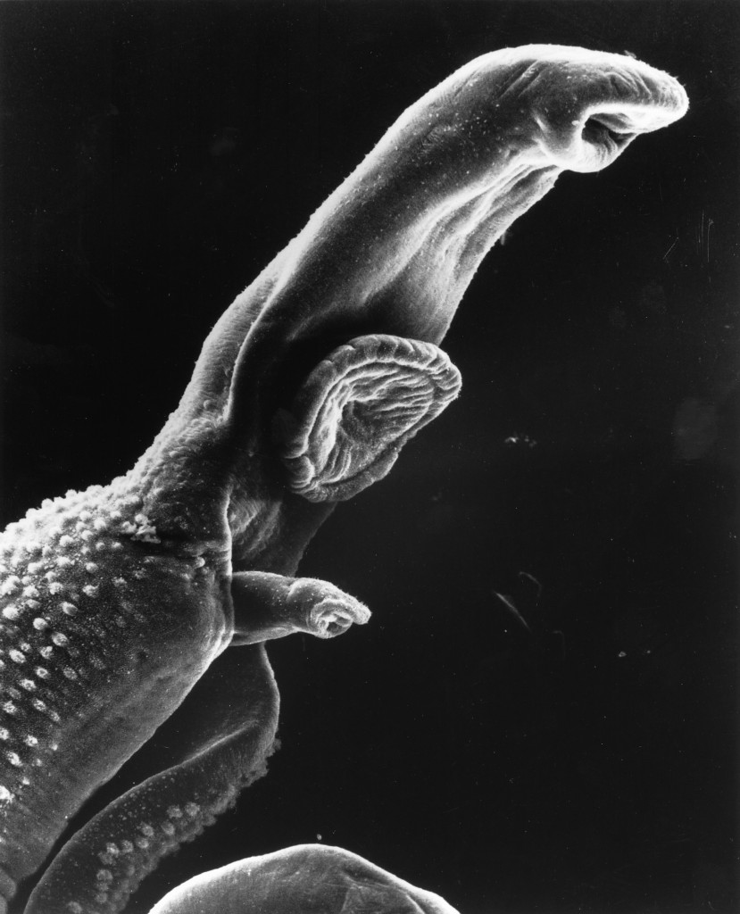 Bild av en schistosomaparasit, förstorad x256 i svepelektronmikroskop.